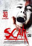Scar 3D